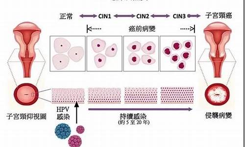 宫颈疾病有什么症状和现象_宫颈疾病有什么