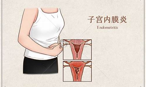 妇科炎症子宫内膜炎_妇科炎症子宫内膜炎和