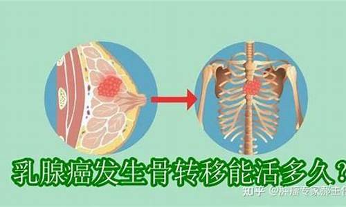 乳腺癌一般能活多少年_乳腺癌一般能活多少