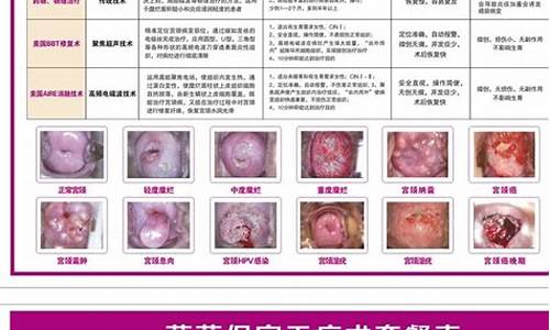 宝鸡宫颈疾病治疗_宝鸡市宫颈癌疫苗在哪个