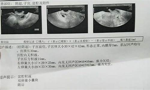 卵巢囊肿算妇科肿瘤吗严重吗_卵巢囊肿算妇