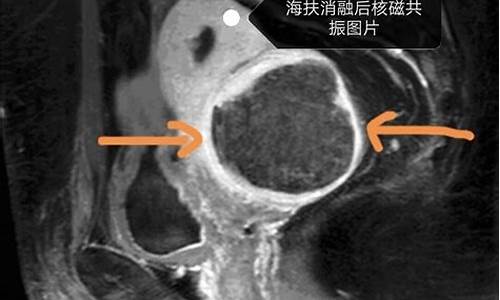 挂宫颈科检查程序_挂号宫颈疾病是看什么的