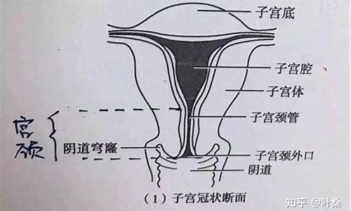 宫颈不是子宫吗_宫颈疾病不包括宫颈下移吗