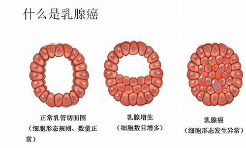 23岁得乳腺增生正常吗_23岁乳腺增生怎么治最好