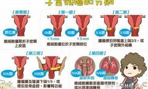 宫颈疾病有哪些前兆_宫颈疾病一般有哪些