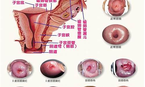 妇科炎症有哪些药效果好_妇科炎症有什么特效药