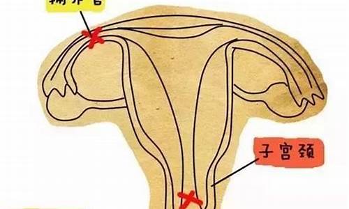 妇科炎症会影响怀孕几率吗_妇科炎症是否影响孕育