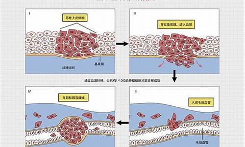 预防乳腺癌的最好方法_预防乳腺癌