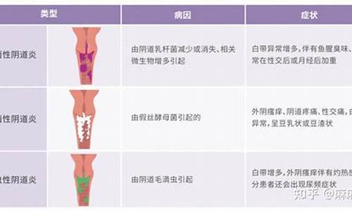 妇科炎症会不会引起腿困_什么妇科炎症会引起腿困