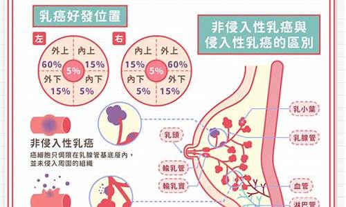 乳腺癌转移部位顺序_乳腺癌