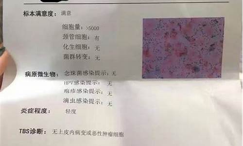 发现妇科炎症如何治疗最好_发现妇科炎症如何治疗