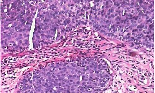 宫颈疾病组织病理学检查_宫劲组织病理检查
